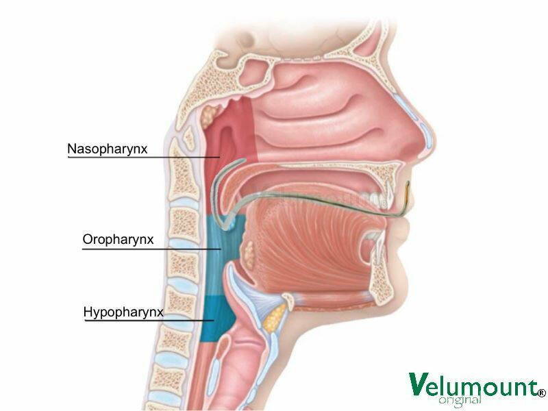 velumount-original-against-snoring-anatomy.jpg